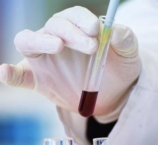 Prevenzione e giovani, cura dei tumori: visite e consulti medici gratuiti davanti alle Università