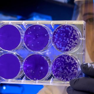 “In settimana le linee guida per i test sierologici in Piemonte”