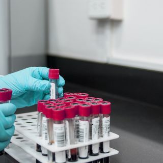Coronavirus, in Piemonte al via lunedì 4 maggio i test sierologici sul personale del servizio sanitario