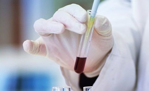 Prevenzione e giovani, cura dei tumori: visite e consulti medici gratuiti davanti alle Università