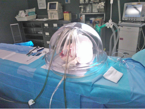 Un polmone pronto a essere trapiantato