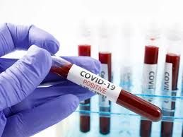 Covid, 908 nuovi positivi. Un ricoverato in più in terapia intensiva, ma crollano quelli generali: -115