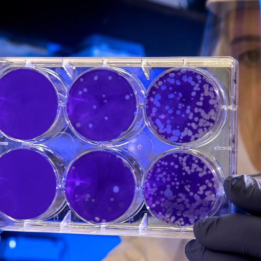 Coronavirus, oggi in Piemonte i guariti (232) sono quasi il triplo dei morti (82). Scendono (-13) i ricoverati in terapia intensiva