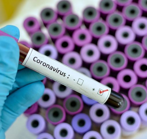 Covid: in Piemonte 116 ricoverati in meno, ma si contano altre 7 vittime