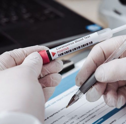 Coronavirus, altri 32 morti in Piemonte. Ma il totale dei guariti sfiora quota 10 mila