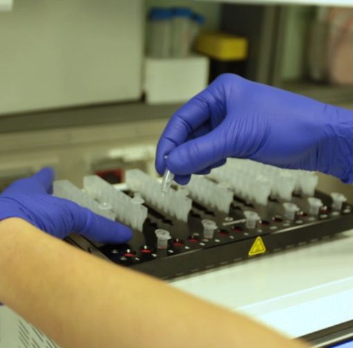 Coronavirus: oggi nessun decesso in Piemonte, le terapie intensive sempre più vuote