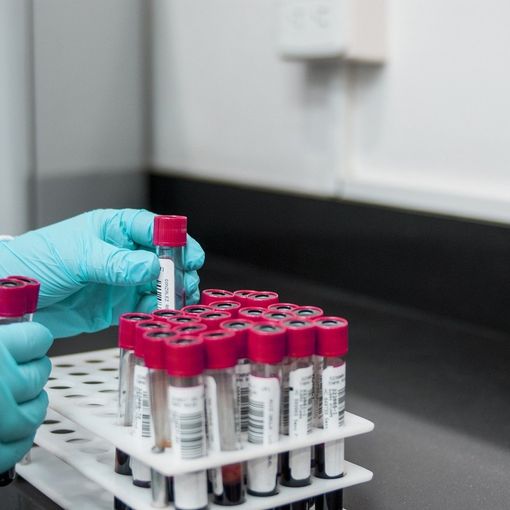 Coronavirus, in Piemonte al via lunedì 4 maggio i test sierologici sul personale del servizio sanitario