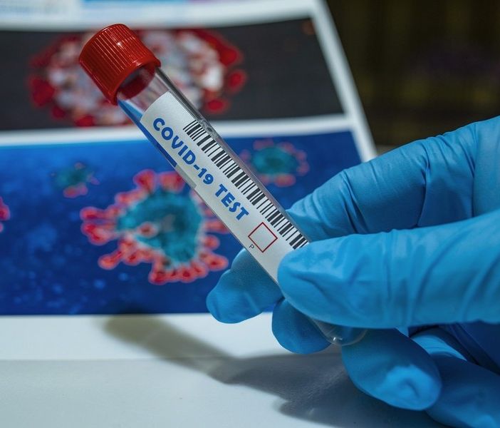Covid, ulteriore calo dei ricoverati: 5 in meno in terapia intensiva. Positivi meno dell'1% dei nuovi tamponi