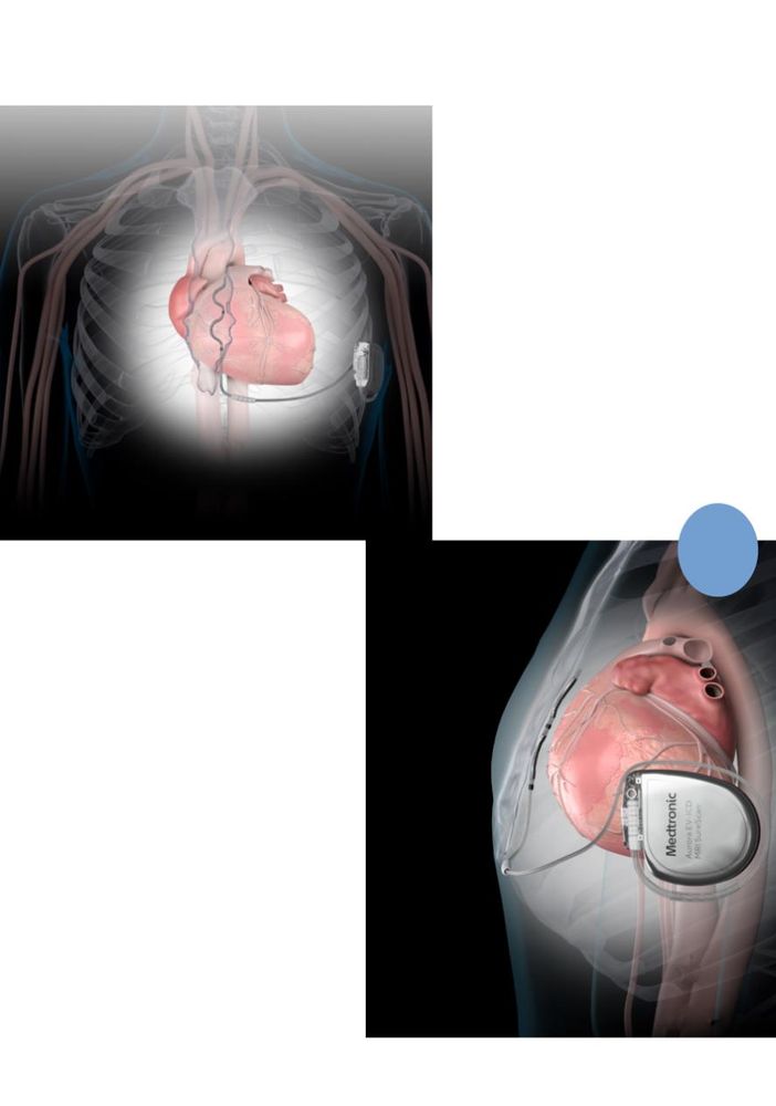 Defibrillatore di ultima generazione salva la vita ad un calciatore ventenne