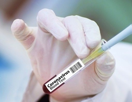 Coronavirus, in Piemonte un positivo su due ha la variante inglese del virus Coronavirus, in Piemonte un positivo su due ha la variante inglese del virus