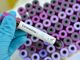 Coronavirus in Piemonte, altri 41 i positivi e 16 i guariti