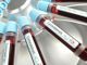 Coronavirus, zero morti nelle ultime 24 ore in Piemonte: i ricoveri calano ulteriormente