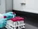 Coronavirus, in Piemonte al via lunedì 4 maggio i test sierologici sul personale del servizio sanitario