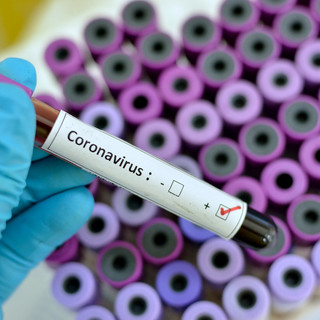 Coronavirus, altri 31 decessi in Piemonte. Ma sono 327 le persone guarite nelle ultime 24 ore