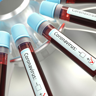 Altri 71 morti per il coronavirus in Piemonte, lieve incremento delle terapie intensive