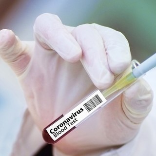 vaccinazione anti Covid - foto di repertorio