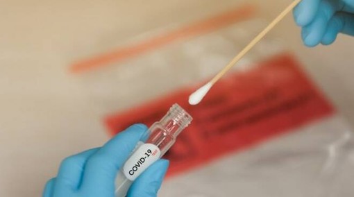 Coronavirus, in Piemonte anche oggi nessun decesso. I ricoverati in terapia intensiva passano da 8 a 6 Coronavirus, in Piemonte anche oggi nessun decesso. I ricoverati in terapia intensiva passano da 8 a 6