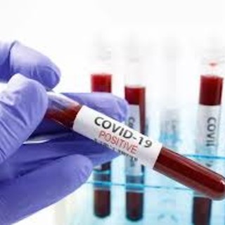 Covid, 908 nuovi positivi. Un ricoverato in più in terapia intensiva, ma crollano quelli generali: -115