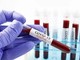 Covid, 908 nuovi positivi. Un ricoverato in più in terapia intensiva, ma crollano quelli generali: -115 Covid, 908 nuovi positivi. Un ricoverato in più in terapia intensiva, ma crollano quelli generali: -115