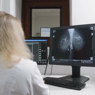 Tumori: a Milano il punto su test genomici e percorsi di cura nel carcinoma mammario