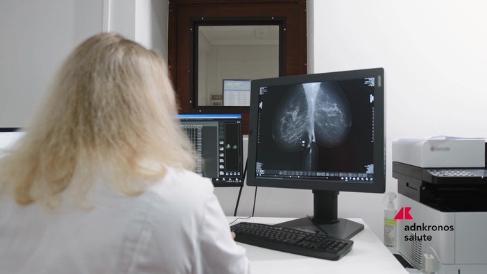 Tumori: a Milano il punto su test genomici e percorsi di cura nel carcinoma mammario