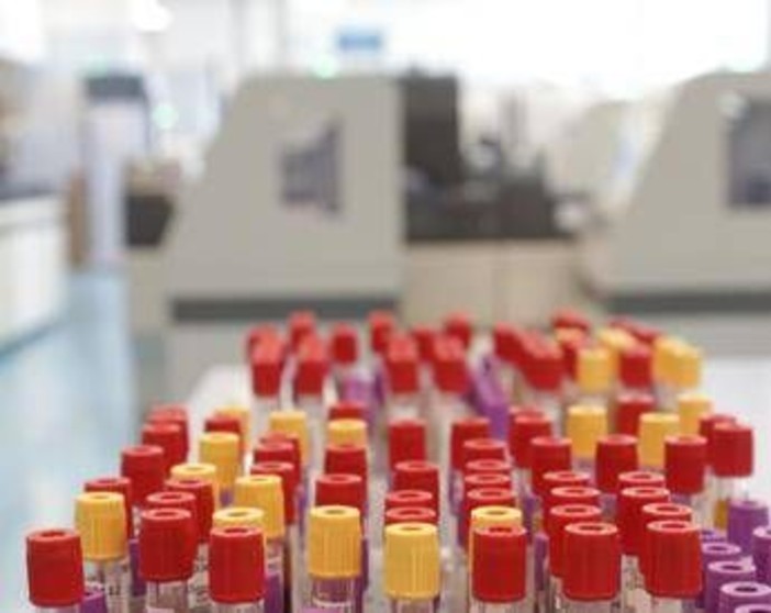 Cos'è il batterio mangiacarne sotto la lente a Messina, minaccia in crescita per il caldo record Cos'è il batterio mangiacarne sotto la lente a Messina, minaccia in crescita per il caldo record