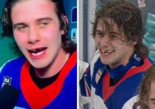 Perde due denti e segna il gol per l'oro, Hughes eroe dell'hockey Usa Perde due denti e segna il gol per l'oro, Hughes eroe dell'hockey Usa