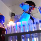 Storia genetica di un superbatterio killer, così l'Acinetobacter baumannii è diventato invulnerabile Storia genetica di un superbatterio killer, così l'Acinetobacter baumannii è diventato invulnerabile