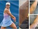 US Open, Stefanini e il livido sul braccio: "Colpa di un controllo antidoping..." US Open, Stefanini e il livido sul braccio: "Colpa di un controllo antidoping..."