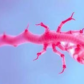 Miastenia, in Sardegna su mille pazienti stimati solo metà nel registro Miastenia, in Sardegna su mille pazienti stimati solo metà nel registro