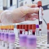 Sclerosi multipla recidivante, Ema raccomanda approvazione ocrelizumab dai 10 anni Sclerosi multipla recidivante, Ema raccomanda approvazione ocrelizumab dai 10 anni