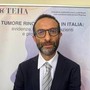 Tumore rinofaringeo, Bossi (Humanitas): "Più ricerca in Europa e cooperazione con la Cina"