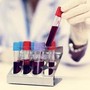 Nuovo tipo di diabete giovanile scoperto in Africa, la conferma che cambia la storia in un maxi studio
