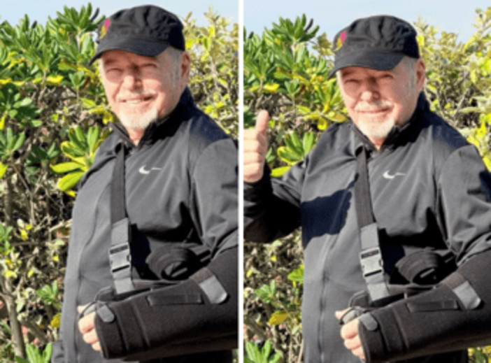 Vasco Rossi cade dalla bici e si rompe i legamenti della spalla: "Un'estate di dolori, tengo duro" Vasco Rossi cade dalla bici e si rompe i legamenti della spalla: "Un'estate di dolori, tengo duro"