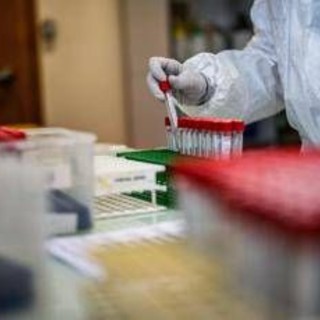 Covid, l'Aspirina frena l'attacco del virus e limita il danno ai polmoni: l'ultimo studio