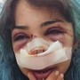 Bari, studentessa picchiata nei bagni denuncia nuovo episodio: "Mi hanno accerchiata"