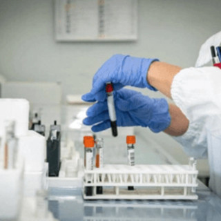 Alzheimer, allo studio nuovo test del sangue per diagnosi precoce Alzheimer, allo studio nuovo test del sangue per diagnosi precoce