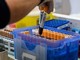 Fegato, un test per scoprire il rischio di gravi malattie entro 10 anni: lo studio