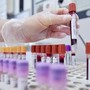 Hiv, dalla Sicilia il modello per estendere terapie long acting