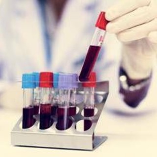 Nuovo tipo di diabete giovanile scoperto in Africa, la conferma che cambia la storia in un maxi studio