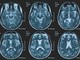 Una persona su 3 ha un disturbo neurologico, a Napoli arriva BrainSpace House Una persona su 3 ha un disturbo neurologico, a Napoli arriva BrainSpace House