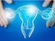 Tumori dell'endometrio, Picardo (Acto Piemonte): "Con dostarlimab trattamenti più efficaci per più donne" Tumori dell'endometrio, Picardo (Acto Piemonte): "Con dostarlimab trattamenti più efficaci per più donne"