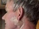 Gordon Ramsay: &quot;Operato per tumore della pelle&quot;