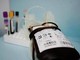 Emergenza sangue in Italia, chi può donarlo e ogni quanto