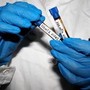 Hantavirus, l'Oms avverte: è più contagioso non appena compaiono i sintomi Hantavirus, l'Oms avverte: è più contagioso non appena compaiono i sintomi