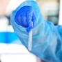 Hantavirus, il punto: contagio e sintomi, cosa c'è da sapere e come proteggersi
