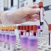 Dal microbiota una speranza contro l'epilessia resistente, lo studio italiano