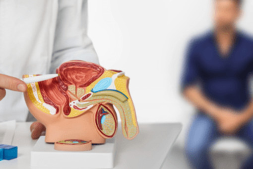 Tumore prostata ad alto rischio recidiva, nuova terapia riduce del 58% rischio morte o metastasi