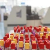 Malaria in aeroporto in Germania, gli esperti: "Campanello d'allarme, ma il rischio resta contenuto" Malaria in aeroporto in Germania, gli esperti: "Campanello d'allarme, ma il rischio resta contenuto"