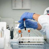 Alzheimer, nuovo test del sangue potrebbe prevedere sintomi imminenti Alzheimer, nuovo test del sangue potrebbe prevedere sintomi imminenti